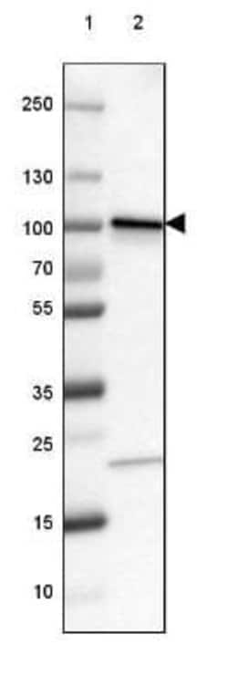 beta-Catenin Antibody (CL3689), Novus Biologicals:Antibodies:Primary Antibodies