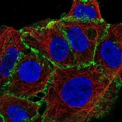 beta-Catenin Antibody (CL3691), Novus Biologicals 100&mu;L:Antibodies,