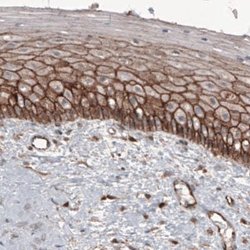 beta-Catenin Antibody (CL3691), Novus Biologicals 100&mu;L:Antibodies,