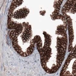 beta-Catenin Antibody (CL3691), Novus Biologicals 100&mu;L:Antibodies,