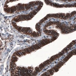 beta-Catenin Antibody (CL3691), Novus Biologicals 100&mu;L:Antibodies,