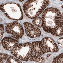 beta-Catenin Antibody (CL3691), Novus Biologicals 100&mu;L:Antibodies,