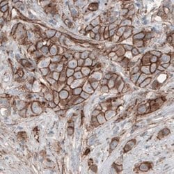 beta-Catenin Antibody (CL3691), Novus Biologicals 100&mu;L:Antibodies,
