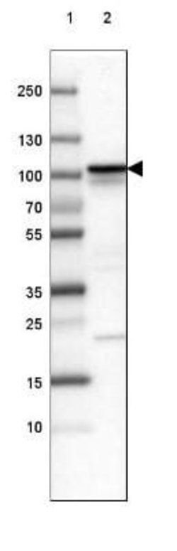 beta-Catenin Antibody (CL3691), Novus Biologicals 100&mu;L:Antibodies,