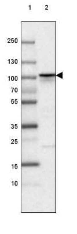 beta-Catenin Antibody (CL3691), Novus Biologicals 100&mu;L:Antibodies,