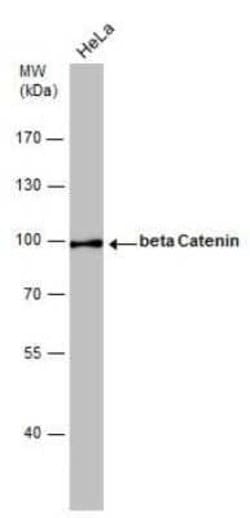 beta-Catenin Antibody (GT2169), Novus Biologicals 100 &mu;g; Unconjugated:Antikörper