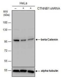 beta-Catenin Antibody (GT2169), Novus Biologicals 100 &mu;g; Unconjugated:Antikörper
