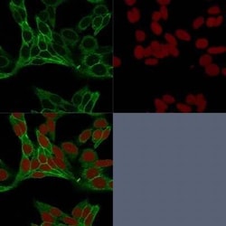 beta-Catenin Antibody (15B8), Novus Biologicals 20&mu;g; Unlabeled:Antibodies,