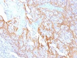 beta-Catenin Antibody (15B8), Novus Biologicals 20&mu;g; Unlabeled:Antibodies,