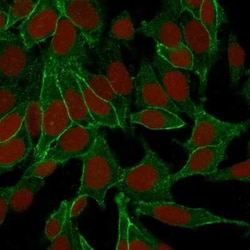 beta-Catenin Antibody (6F9), Novus Biologicals 20&mu;g; Unlabeled:Antibodies,