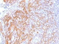 beta-Catenin Antibody (6F9), Novus Biologicals 20&mu;g; Unlabeled:Antibodies,