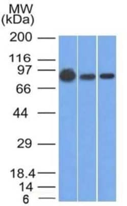 beta-Catenin Antibody (9F2), Novus Biologicals:Antibodies:Primary Antibodies