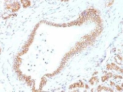 beta-Catenin Antibody (CTNNB1/1507) - Azide and BSA Free, Novus Biologicals:Antibodies:Primary