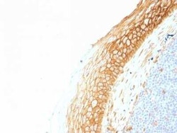 beta-Catenin Antibody (CTNNB1/1507) - Azide and BSA Free, Novus Biologicals:Antibodies:Primary