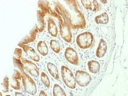 beta-Catenin Antibody (CTNNB1/1507) - Azide and BSA Free, Novus Biologicals:Antibodies:Primary