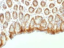 beta-Catenin Antibody (CTNNB1/1507) - Azide and BSA Free, Novus Biologicals:Antibodies:Primary