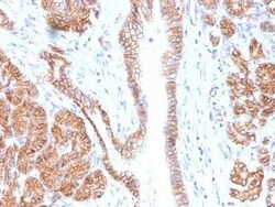 beta-Catenin Antibody (CTNNB1/1508) - Azide and BSA Free, Novus Biologicals 100 &mu;g | Buy Online | Novus Biologicals | Fisher Scientific