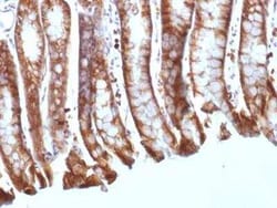 beta-Catenin Antibody (CTNNB1/1508) - Azide and BSA Free, Novus Biologicals 100 &mu;g | Buy Online | Novus Biologicals | Fisher Scientific