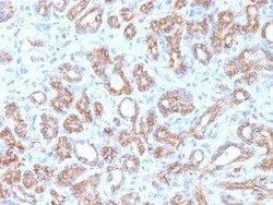 beta-Catenin Antibody (CTNNB1/1509) - Azide and BSA Free, Novus Biologicals:Antibodies:Primary