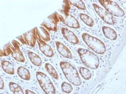beta-Catenin Antibody (CTNNB1/1509) - Azide and BSA Free, Novus Biologicals:Antibodies:Primary