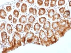 beta-Catenin Antibody (CTNNB1/1509) - Azide and BSA Free, Novus Biologicals:Antibodies:Primary