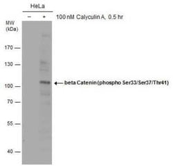 beta-Catenin, p Ser37, p Thr41, p Ser33 Antibody, Novus Biologicals 100