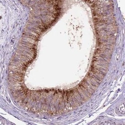 beta-Galactosidase-1/GLB1 Antibody, Novus Biologicals:Antibodies:Primary
