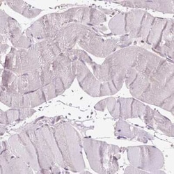 beta-Galactosidase-1/GLB1 Antibody, Novus Biologicals:Antibodies:Primary