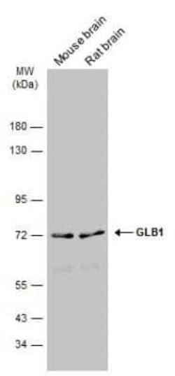 beta-Galactosidase-1/GLB1 Antibody, Novus Biologicals 100 &mu;g | Buy Online | Novus Biologicals | Fisher Scientific