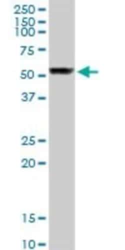 beta I Tubulin Antibody, Novus Biologicals 0.1 mg; Unconjugated:Antibodies,