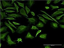 beta II Tubulin A Antibody (2B2), Novus Biologicals 0.1 mg | Buy Online | Novus Biologicals | Fisher Scientific