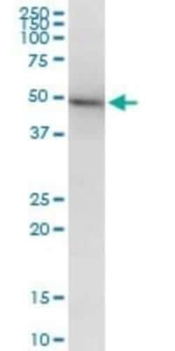 beta II Tubulin A Antibody (2B2), Novus Biologicals 0.1 mg | Buy Online | Novus Biologicals | Fisher Scientific
