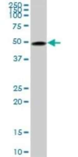 beta II Tubulin A Antibody (2B2), Novus Biologicals 0.1 mg | Buy Online | Novus Biologicals | Fisher Scientific