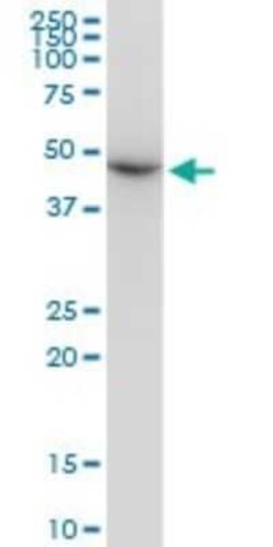 beta II Tubulin A Antibody (2B2), Novus Biologicals 0.1 mg | Buy Online | Novus Biologicals | Fisher Scientific