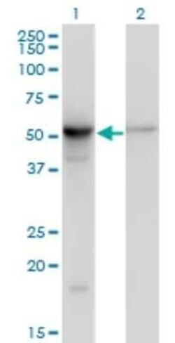 beta II Tubulin A Antibody (2B2), Novus Biologicals 0.1 mg | Buy Online | Novus Biologicals | Fisher Scientific