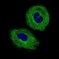 beta-III Tubulin Antibody (CL5813), Novus Biologicals 25 &mu;L:Antibodies,