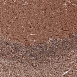 beta-III Tubulin Antibody (CL5813), Novus Biologicals 25 &mu;L:Antibodies,