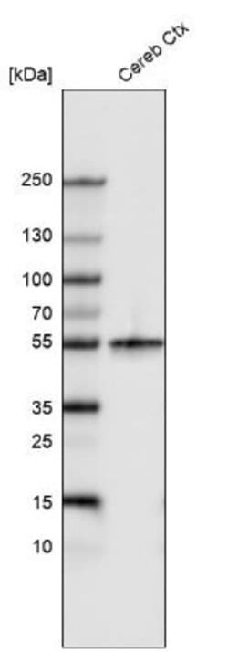 beta-III Tubulin Antibody (CL5813), Novus Biologicals 25 &mu;L:Antibodies,