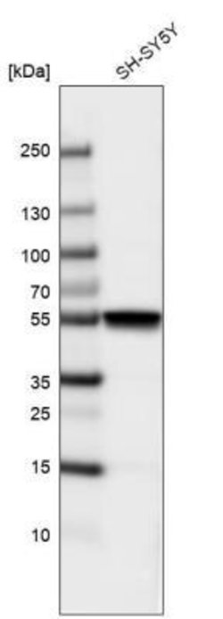 beta-III Tubulin Antibody (CL5813), Novus Biologicals 25 &mu;L:Antibodies,