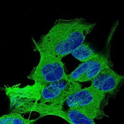 beta-III Tubulin Antibody (CL5814), Novus Biologicals 25 &mu;L:Antibodies,
