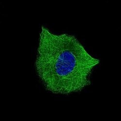 beta-III Tubulin Antibody (CL5814), Novus Biologicals 25 &mu;L:Antibodies,
