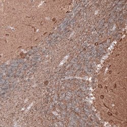 beta-III Tubulin Antibody (CL5814), Novus Biologicals 25 &mu;L:Antibodies,