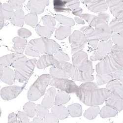 beta-III Tubulin Antibody (CL5814), Novus Biologicals 25 &mu;L:Antibodies,