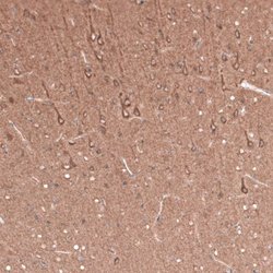 beta-III Tubulin Antibody (CL5814), Novus Biologicals 25 &mu;L:Antibodies,
