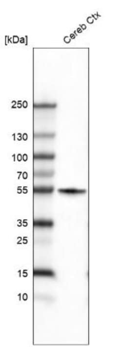 beta-III Tubulin Antibody (CL5814), Novus Biologicals 25 &mu;L:Antibodies,