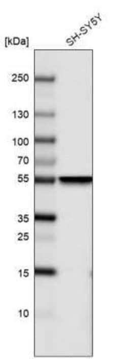 beta-III Tubulin Antibody (CL5814), Novus Biologicals 25 &mu;L:Antibodies,