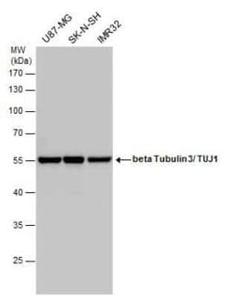 beta-III Tubulin Antibody (GT1338), Novus Biologicals 100 &mu;g; Unconjugated:Antibodies,