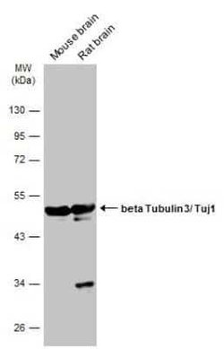 beta-III Tubulin Antibody (GT1338), Novus Biologicals 100 &mu;g; Unconjugated:Antibodies,