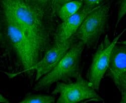 beta-III Tubulin Antibody (SP06-00), Novus Biologicals 100&mu;L:Antibodies,