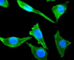 beta-III Tubulin Antibody (SP06-00), Novus Biologicals 100&mu;L:Antibodies,